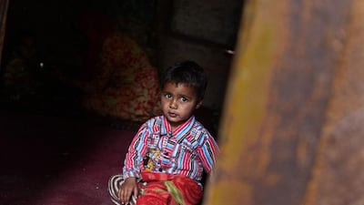 The child of a leper patient sits in his family's room at the leprosy hospital in Srinagar, the summer capital of Indian Kashmir.