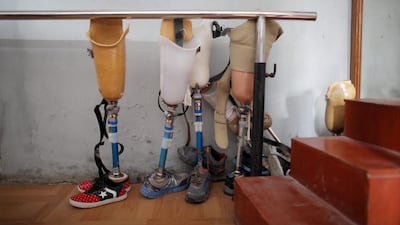 Prosthetics at an orthopaedic rehabilitation centre in Kathmandu. Dan Maya Maharjan is among those who has received a prosthetic limb as she rebuilds her life after the earthquake. Last Thursday was International Day of Persons with Disabilities. Niranjan Shrestha / AP Photo