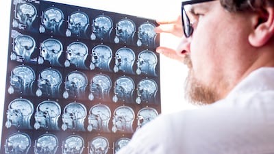 Sixty-four in every 100,000 Emiratis in Abu Dhabi are diagnosed with MS, which is double the global rate. Getty Images