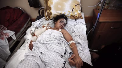 The high toll on civilians, and especially children, has damaged Israel's international image, the Arabic language press is saying. Photo: EPA / Mohammed Saber