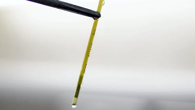 Success rates for embryo transfer are now as high as 65 to 70 per cent, but that reflects decades of accumulated expertise. Reem Mohammed / The National