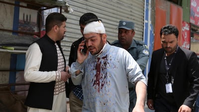 An injured man talks on his mobile phone after an explosion in Kabul, Afghanistan. AP Photo