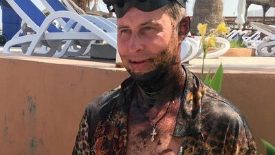 A hotel guest is covered with oil after a spill washed ashore near Fujairah’s Snoopy island.