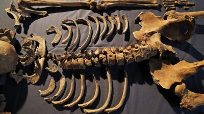 these were, by and large, poor people. Many of the skeletons showed signs of malnutrition consistent with the “Great Famine” that struck Europe 30 years before the Black Death. Many had back injuries suggesting lives of hard labour. One man became a vegetarian late in life, indicating he may have entered an order of monks.