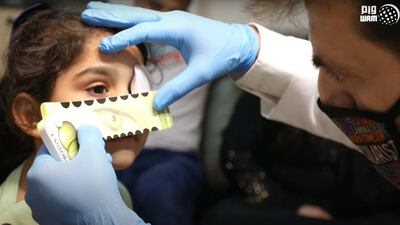 Sama has her eye measured so a matching prosthetic can be made. Wam