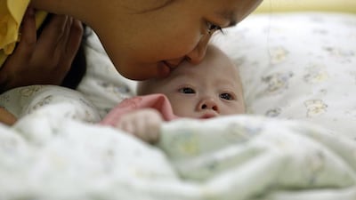 Gammy, a baby born with Down’s Syndrome, is kissed by his surrogate mother Pattaramon Chanbua. Reuters / August 3, 2014.
