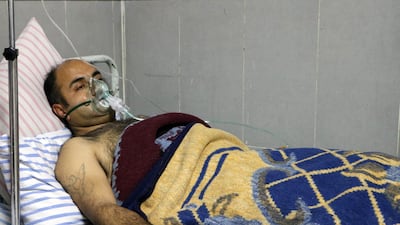 A picture taken on February 16, 2018, shows a Syrian man receiving treatment at a hospital in the town of Afrin. Six men were treated for breathing difficulties in the main hospital in Afrin after shelling by a Turkish-led offensive on their village, the general director of the Afrin hospital said. Ahmad Shafie Bilal/ AFP Photo