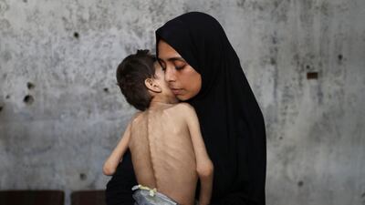 Samah Matar holds her malnourished son Youssef, who suffers from cerebral palsy, at the school in Gaza city where they shelter. Reuters