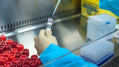 Unilabs, a European diagnostic services firm who is working with health authorities in the UAE has recently developed a new PCR test aimed at identifying the highly contagious Delta variant.