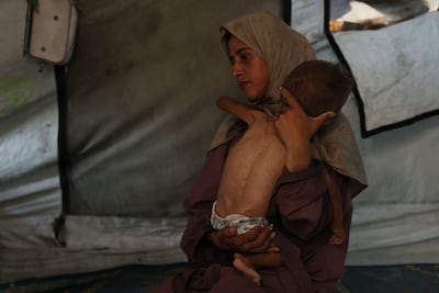 A mother with her malnourished 18-month-old son at Al Shati refugee camp, west of Gaza city. AFP