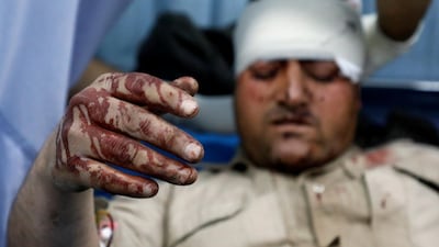 An Afghan injured man receives treatment at a hospital after a car bomb blast in Kabul, Afghanistan January 14, 2019. Reuters