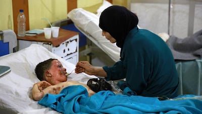 A severely burned young boy is fed as he lies in the intensive care unit of a hospital in the rebel-held area of Douma, east of the capital Damascus, following reported mortar shelling by Syrian government forces on August 28, 2015. Abd Doumany/AFP Photo