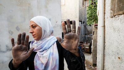 Palestinian Samah Sabagh shows her hands after the two-day Israeli raid in Jenin. Reuters
