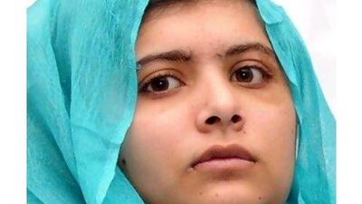 Malala Yousufzai deserves support, a reader says. AFP / Queen Elizabeth Hospital/University Hospitals Birmingham