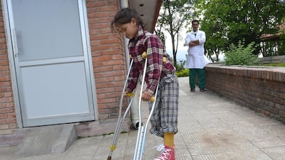 Nepalese child Maya Gurung is watched by a doctor as she walks with the aid of crutches in the grounds of a hospital in Banepal on the outskirts of Kathmandu. Maya is among thousands of Nepalese who face a daunting future after suffering loss of limbs, spinal and other permanent injuries in the twin quakes that claimed more than 8,700 lives. AFP PHOTO/Prakash MATHEMA
