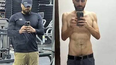 Journalist Mohammad Badr said he was struck so hard his tongue was cut, and he could barely speak or eat for twoweeks. He told CPJ he lost 40 kilograms over 10 months of incarceration. Photo: CPJ / Mohammad Badr