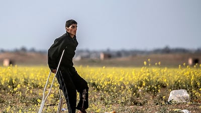 A man walks using a crutch towards a screening point. AFP
