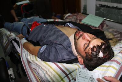 An earthquake victim is treated at Sulaimaniyah Hospital. AFP PHOTO / SHWAN MOHAMMED