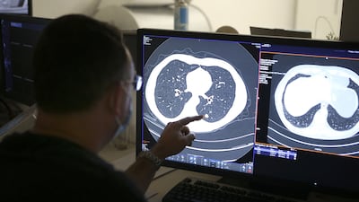 The collection of better data would help scientists to understand the cancer threat to the Middle East. AFP