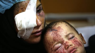 A Lebanese woman, Ghadeer Mortada, 18, who was wounded along with three members of her family, holds her one-year-old boy, Mohammed, in a hospital on Sunday, February 2, 2014., after a deadly car bomb exploded on Saturday evening, in the predominately Shiite town of Hermel, about 16 kilometres from the Syrian border in northeast Lebanon. Hussein Malla/AP Photo