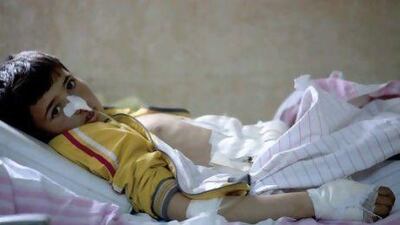 Nazem Najar, 12, rests in a hospital bed after being wounded during fighting in northern Syria on Wednesday.