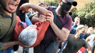 Abdullah El Hajj following his injury. Courtesy Abdullah El Hajj