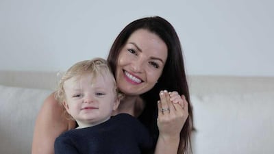 Rhian Adams and her son Samson Oliver Turton, who is 14 months. Oliver was diagnosed with the condition when he was 10 months old. Photo: Brittany Joy
