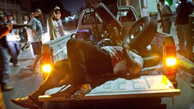 epa02877452 A man wounded by a sniper come to a rebel makeshift checkpoint during the night after the revels enter Tripoli on 22 August 2011. US President Barack Obama calledon 22 August 2011 for 'an inclusive transition that leads to a democratic Libya,' after the fall of most of the capital Tripoli to rebels seeking to oust leader Muammar Gaddafi. 'The situation is still very fluid. There remains a degree of uncertainty, and there are still regime elements who pose a threat,' Obama said. "But this much is clear: The Gaddafi regime is coming to an end, and the future of Libya is in the hands of its people." EPA/MARCO SALUSTRO a