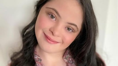 Ellie Goldstein is the first model with Down syndrome to pose for Gucci Beauty. Instagram / @elliejg16_zebedeemodel