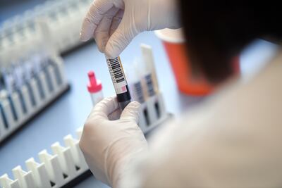 Sonja Krauthoefer, of the University Hospital Erlangen, checks donated blood and plasma samples. Reuters