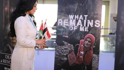 Jordanian-Yemeni filmmaker Nisreen Al Sbeihi Noman's film What Remains of Me, documents the stories of children that have lost limbs to mines in the city of Taiz. Credit: Nisreen Al Sbeihi Noman