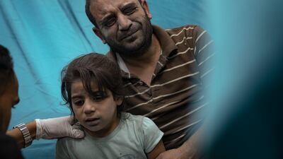 Palestinians wounded in the Israeli bombardment of the Gaza Strip are treated in a hospital in Khan Younis, on October 17. AP