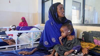Hajira Ali holds her malnourished child, Farhia Hassan, 2.