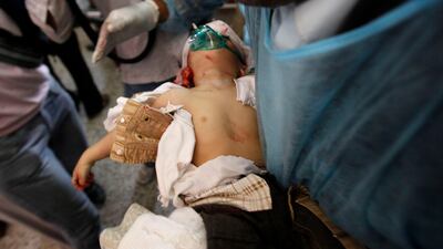 A medic attends to Anees, a nine-month-old baby boy, who died later, after being shot while he was in his mother's car during clashes between security forces and defected army soldiers backing anti-government protesters in Sanaa on September 19 2011. Kha???