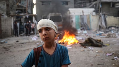 An injured Palestinian boy stands next to the rubble of a family house that was hit overnight in Israeli bombardment in the Tal Al Sultan neighbourhood of Rafah in southern Gaza. AFP