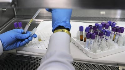 Researchers face the challenge of antibiotic-resistant superbugs. Sia Kambou / AFP