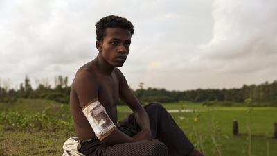 Ahammed Ullah, 20, from Saitaburuikka, Maungdaw was shot in the arm when the Myanmar military attacked his village. More than 270,000 Rohingya refugees have fled across the border from Rakhine State, Myanmar, into Bangladesh since 25 August. As many as 80 per cent of them are women and children. Many more children in need of support and protection remain in the areas of northern Rakhine State that have been wracked by violence. Patrick Brown / Amnesty International