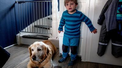Oskar, 3, who suffers from a rare genetic defect, stands next to family dog Bruno. AP Photo