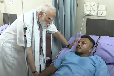 Vishwash Kumar Ramesh, sole survivor of the Air India flight 171 crash, is visited by India's Narendra Modi at a hospital in Ahmedabad. AFP