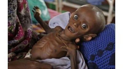 Minhaj Gedi Farah was severely malnourished when he arrived at the Dadaab refugee camp in Kenya late last month.