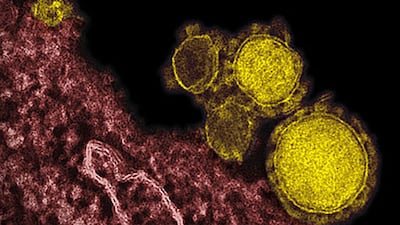 A man from Al Ain has tested positive for the Mers virus, the World Health Organisation confirmed on Monday. AP