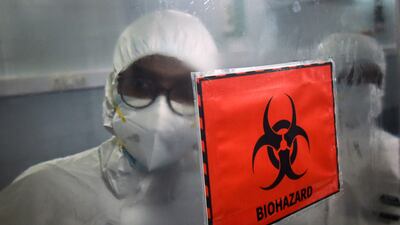 The Pan American Health Organisation has said that anyone can catch monkeypox regardless of gender or sexual orientation.. EPA