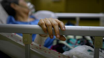 A Covid-19 patient keeps her hand on the bed railing at the ICU of the Ana Francisca Perez de Leon II public Hospital in Caracas, Venezuela. AP Photo