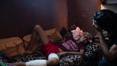 Raed Abu Khader, right, holds a wet cloth on the forehead of his 12-year-old son Mohammed in Gaza City. Mohammed was shot in the leg at one of the demonstrations on Gaza strip's border with Israel. Ever since Hamas launched demonstrations in March against Israel's blockade of Gaza, children have been a constant presence in the crowds. Since then, U.N. figures show that 948 children under 18 have been shot by Israeli forces and 2,295 have been hospitalized, including 17 who have had a limb amputated. AP