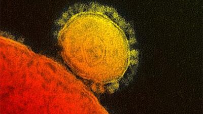 Middle East respiratory syndrome coronavirus (MERS-CoV) has infected 77 people worldwide and killed 40, according to the latest figures from the World Health Organization (WHO). AP Photo