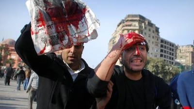 Injured anti-Mubarak protesters bleed following clashes with his supporters in Cairo.