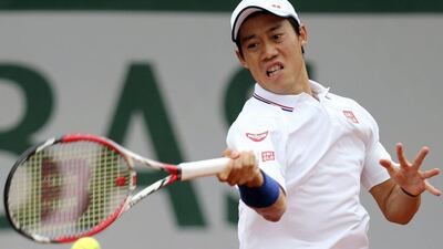 David Vincent / AP Photo