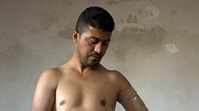 Nabil Siyam,34, who lost his arm and sustained other injuries stands with his son Badruddin, 5 at their home in Rafa, Gaza December 29,2014 . Nabil and his son were injured when an Israeli bomb exploded outside there home on July 21 during last summer’s war . The explosion killed Nabil’s wife Shireen and 4 of his children . The attack also claimed the lives of his two brother’s and their wives and three of their children who were all staying at the house . Badruddin lost a kidney . Heidi Levine for The National