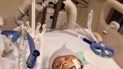 Baby Abbas's treatment racked up millions of dirhams in medical bills, which the hospital generously waived. Photo: Syed Iftikhar