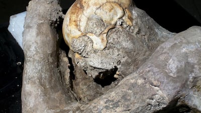 A 16-layer scan has to be used to penetrate the hardened plaster but the results show impressive skeletal remains and near perfect teeth. Alessandro Bianchi / Reuters